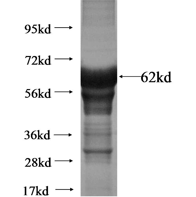 ARRDC2 fusion protein Ag14056 SDS-PAGE ARRDC2 fusion protein Ag14056 SDS-PAGE