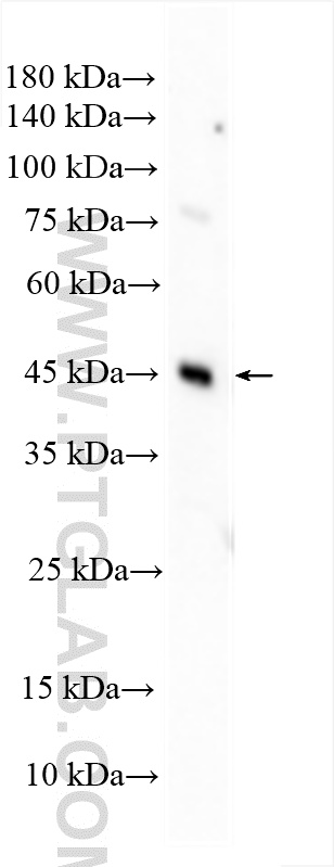 WB analysis of HeLa using 25060-1-AP WB analysis of HeLa using 25060-1-AP