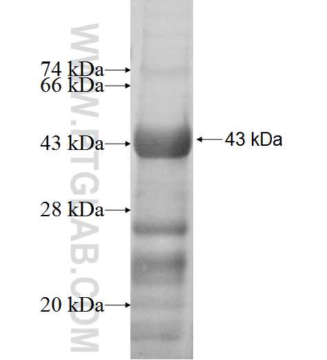 ARSB fusion protein Ag6924 SDS-PAGE