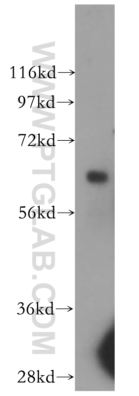 WB analysis of human placenta using 11805-1-AP