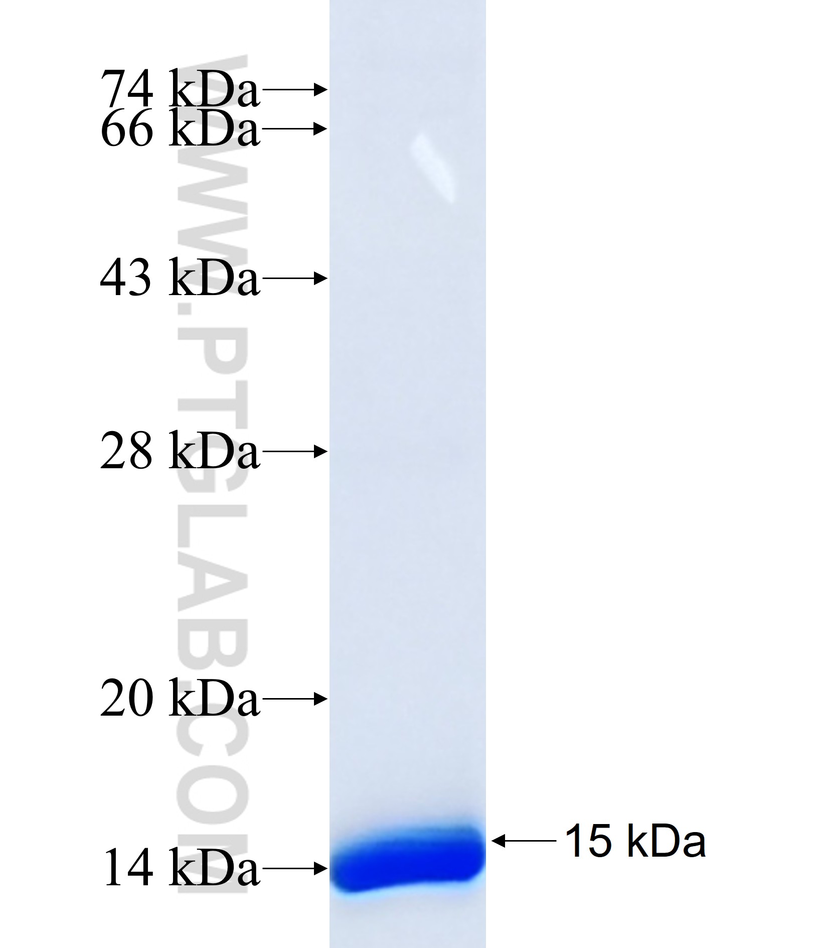 ARSE fusion protein Ag35597 SDS-PAGE ARSE fusion protein Ag35597 SDS-PAGE