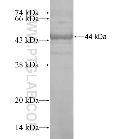 ARSI fusion protein Ag18884 SDS-PAGE