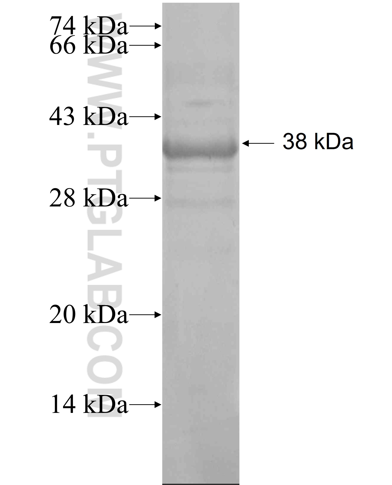 ARSI fusion protein Ag18884 SDS-PAGE