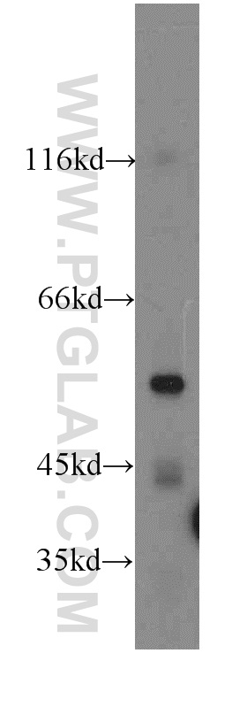 WB analysis of HeLa using 19749-1-AP