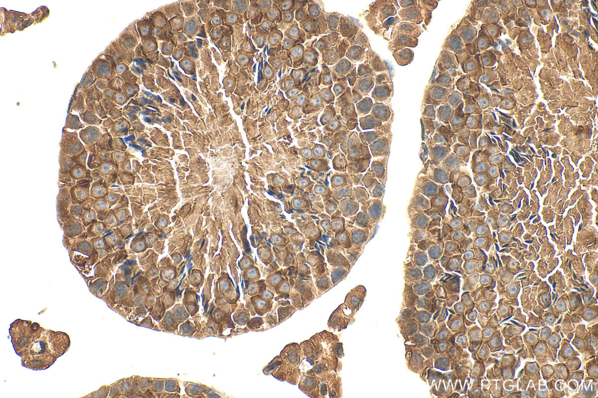 IHC staining of mouse testis using 15930-1-AP