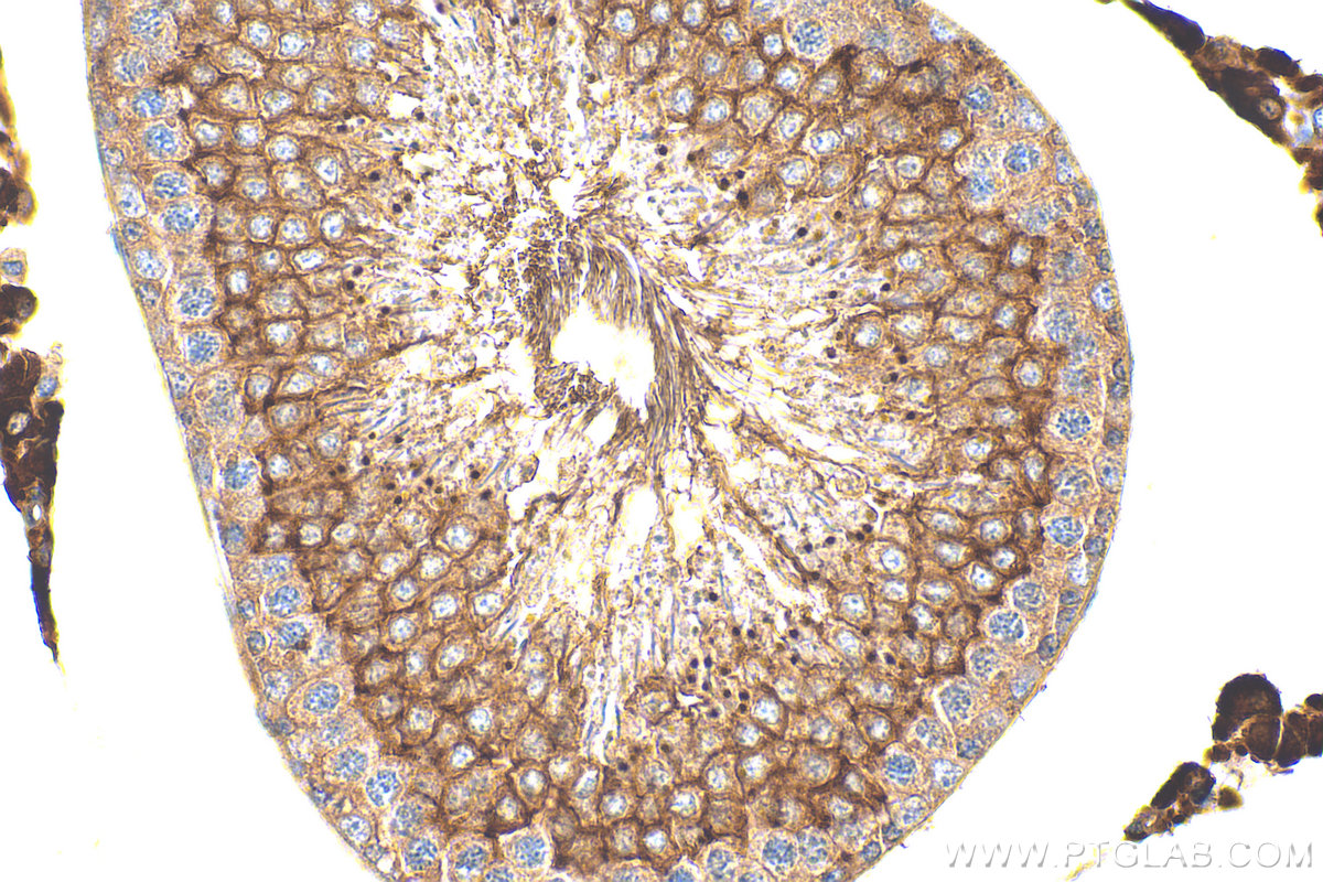 IHC staining of rat testis using 15930-1-AP