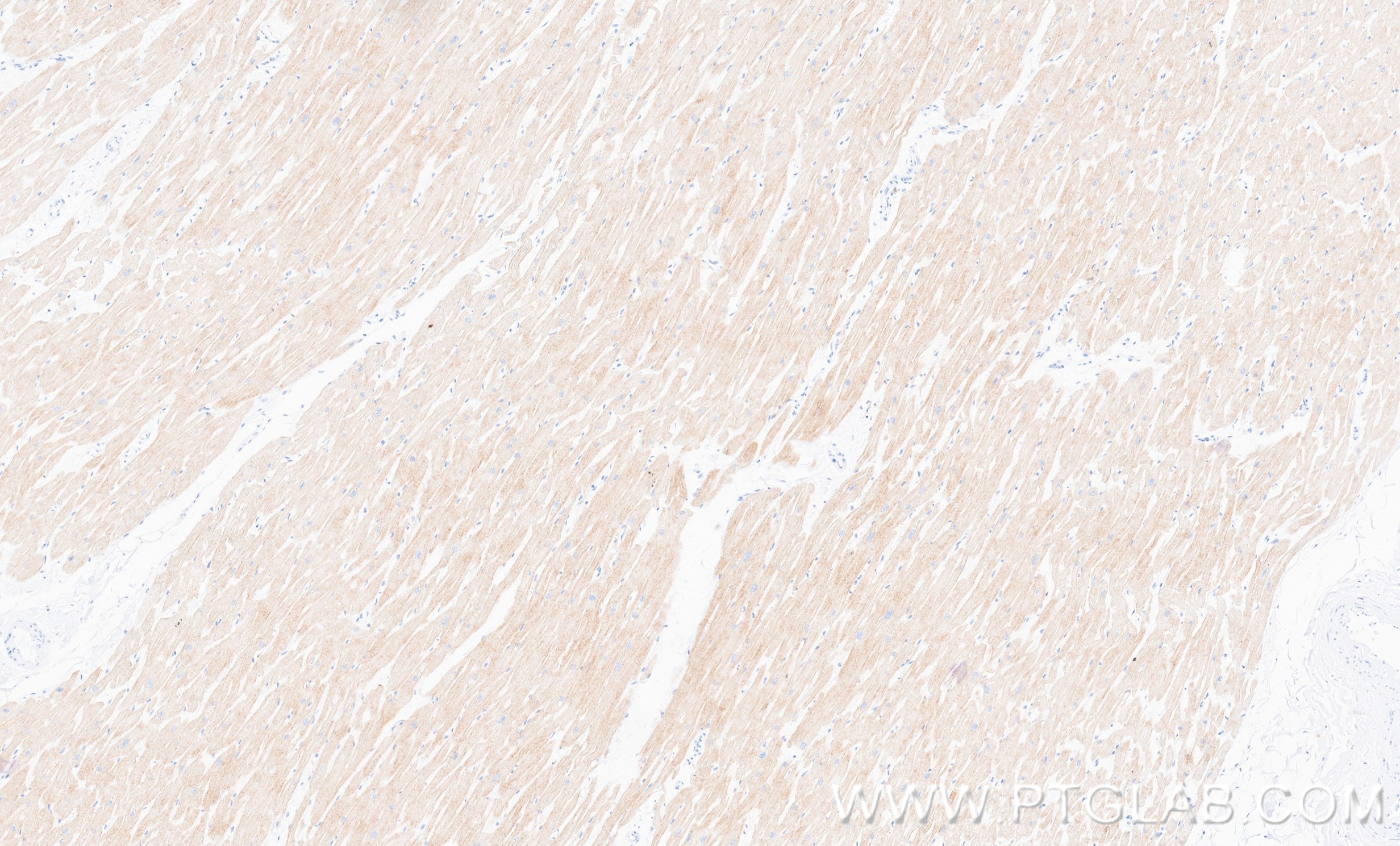 IHC staining of human heart using 87108-1-RR IHC staining of human heart using 87108-1-RR