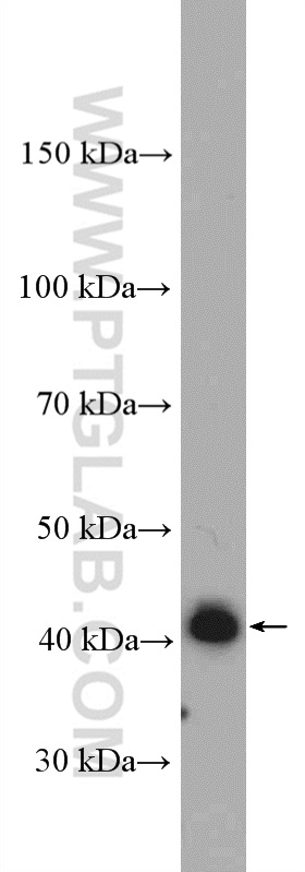 WB analysis of mouse liver using 27270-1-AP