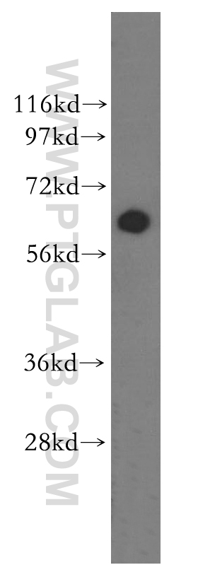 ASAH1 Polyclonal antibody