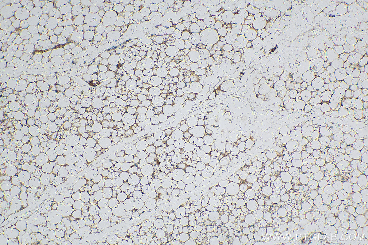 IHC staining of mouse brown adipose using 16127-1-AP