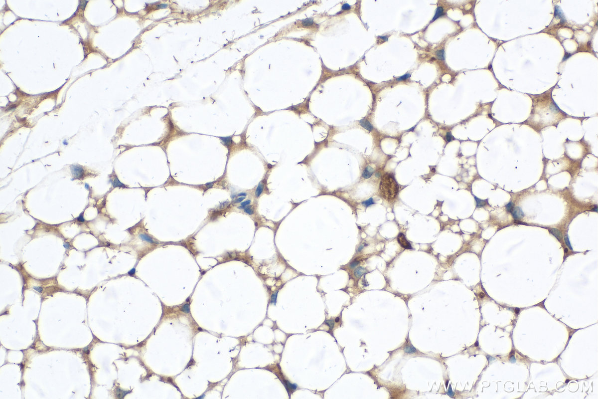 IHC staining of mouse brown adipose using 16127-1-AP