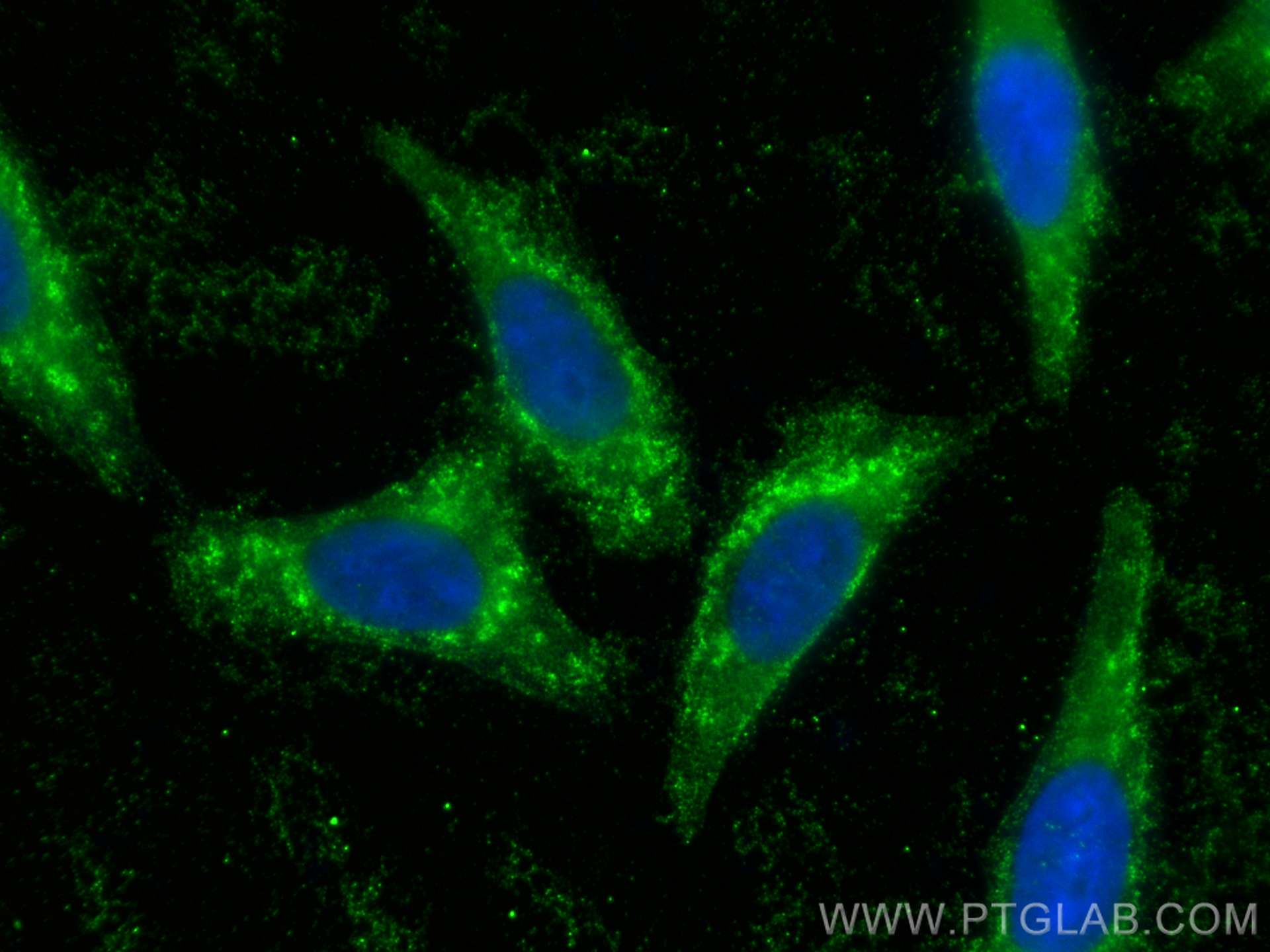 IF Staining of HepG2 using 14099-1-AP