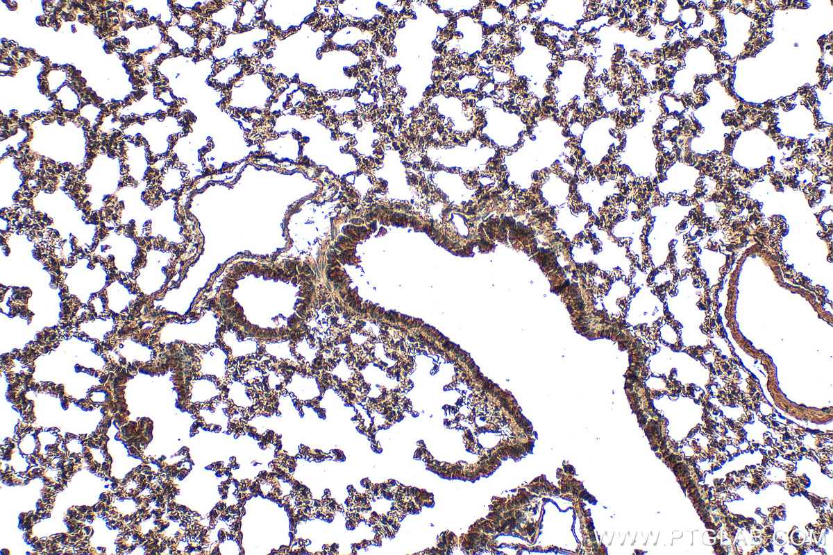 IHC staining of mouse lung using 14099-1-AP