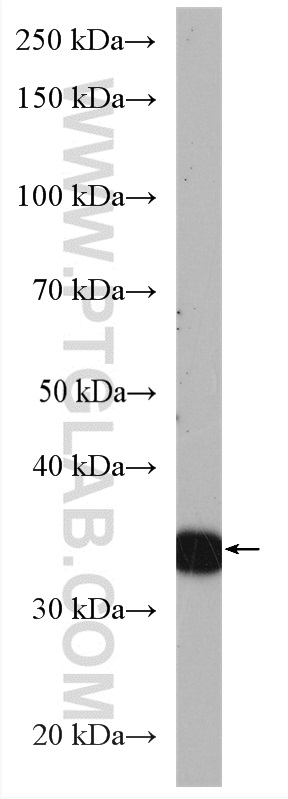 WB analysis of mouse spleen using 16095-1-AP