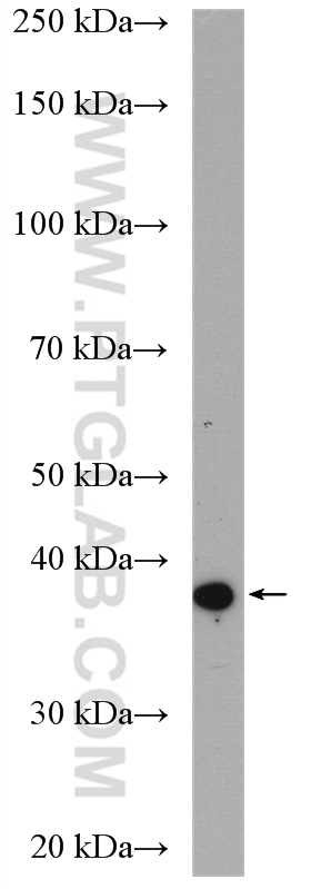 ASB1