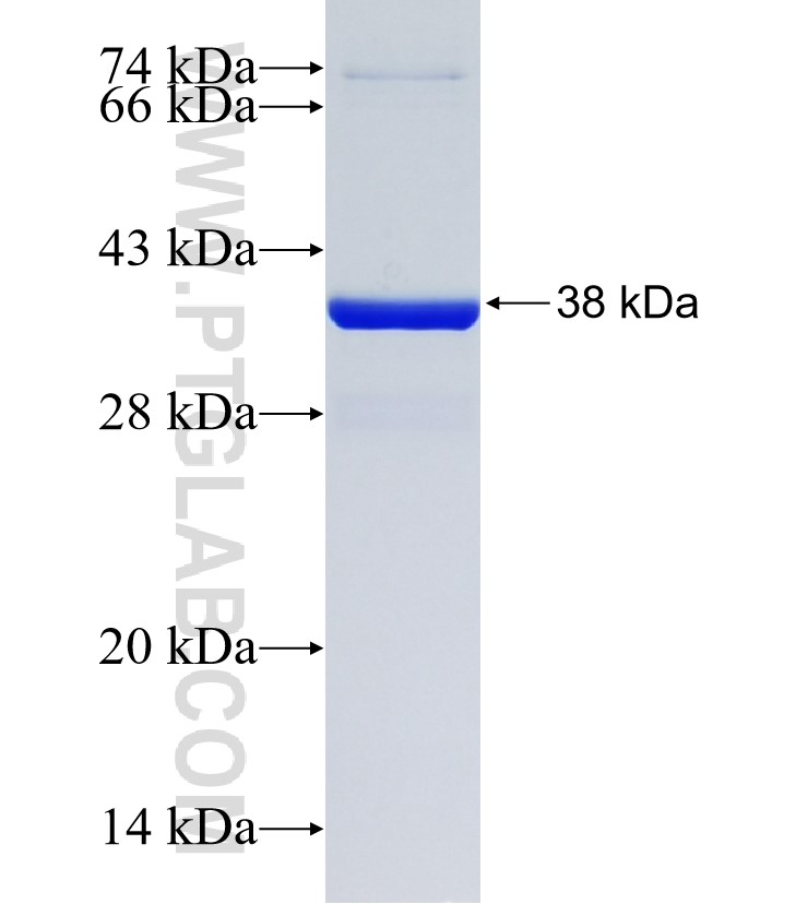 ASB10 fusion protein Ag21221 SDS-PAGE