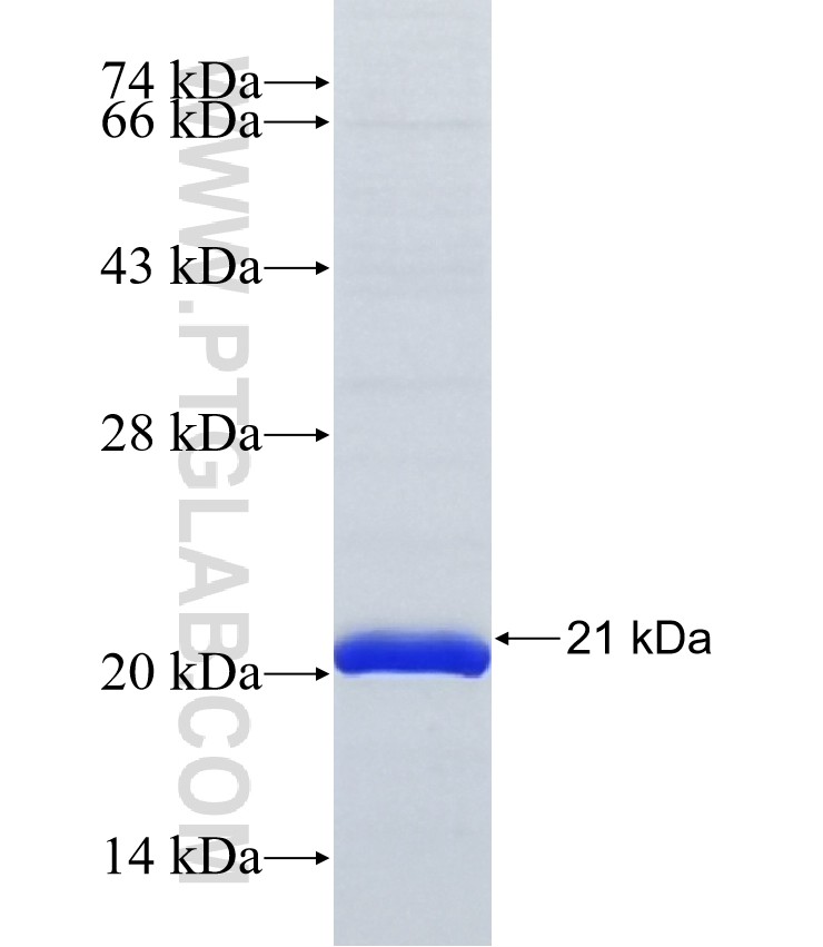 ASB12 fusion protein Ag37012 SDS-PAGE