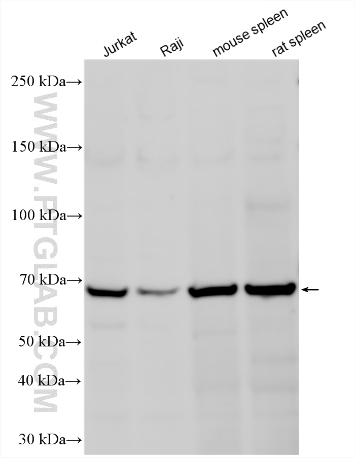 WB analysis using 25300-1-AP (same clone as 25300-1-PBS) WB analysis using 25300-1-AP (same clone as 25300-1-PBS)