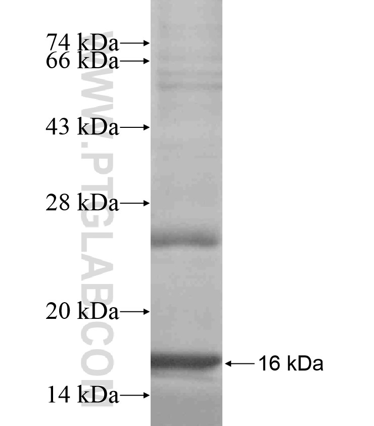 ASB14 fusion protein Ag18147 SDS-PAGE