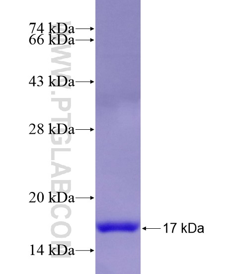 ASB17 fusion protein Ag28867 SDS-PAGE ASB17 fusion protein Ag28867 SDS-PAGE