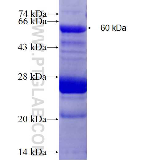 ASB17 fusion protein Ag5315 SDS-PAGE