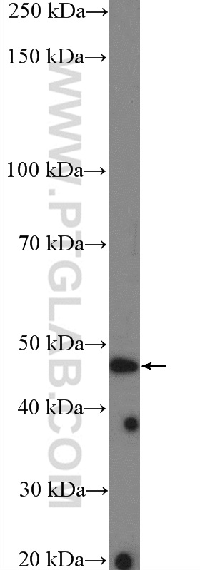 ASB6