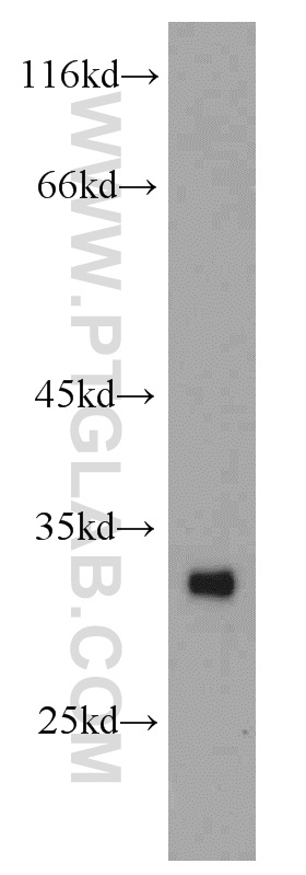 WB analysis of human heart using 11735-1-AP (same clone as 11735-1-PBS)