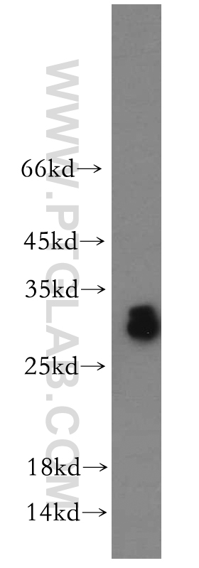 WB analysis of human testis using 11952-1-AP