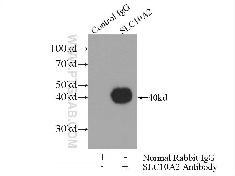 IP experiment of mouse kidney using 25245-1-AP