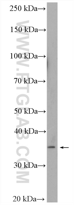 WB analysis of mouse small intestine using 25245-1-AP