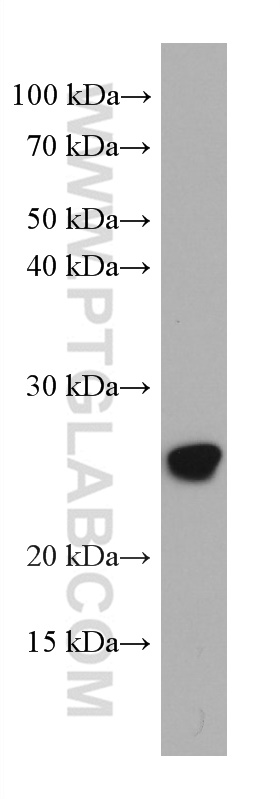 ASC/TMS1