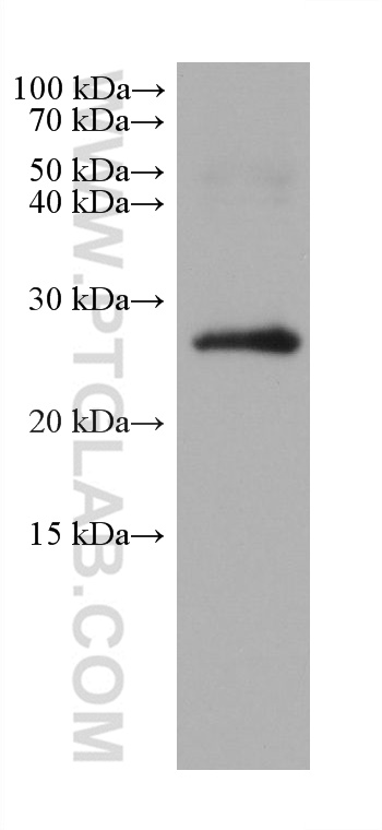 WB analysis of human placenta using 67494-1-Ig