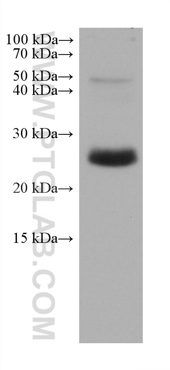 WB analysis of rat spleen using 67494-1-Ig