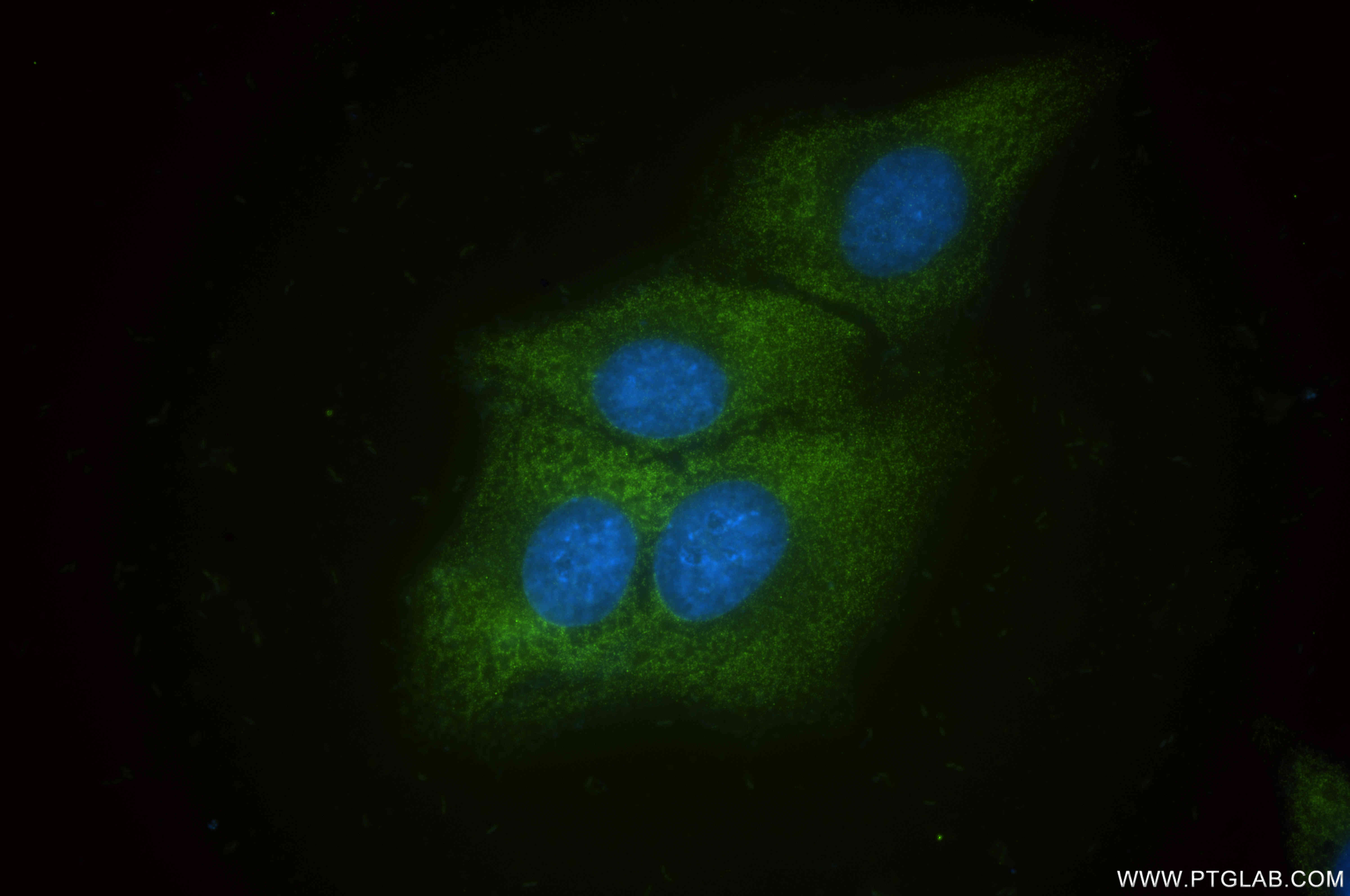 IF Staining of HepG2 using 86086-1-RR (same clone as 86086-1-PBS)