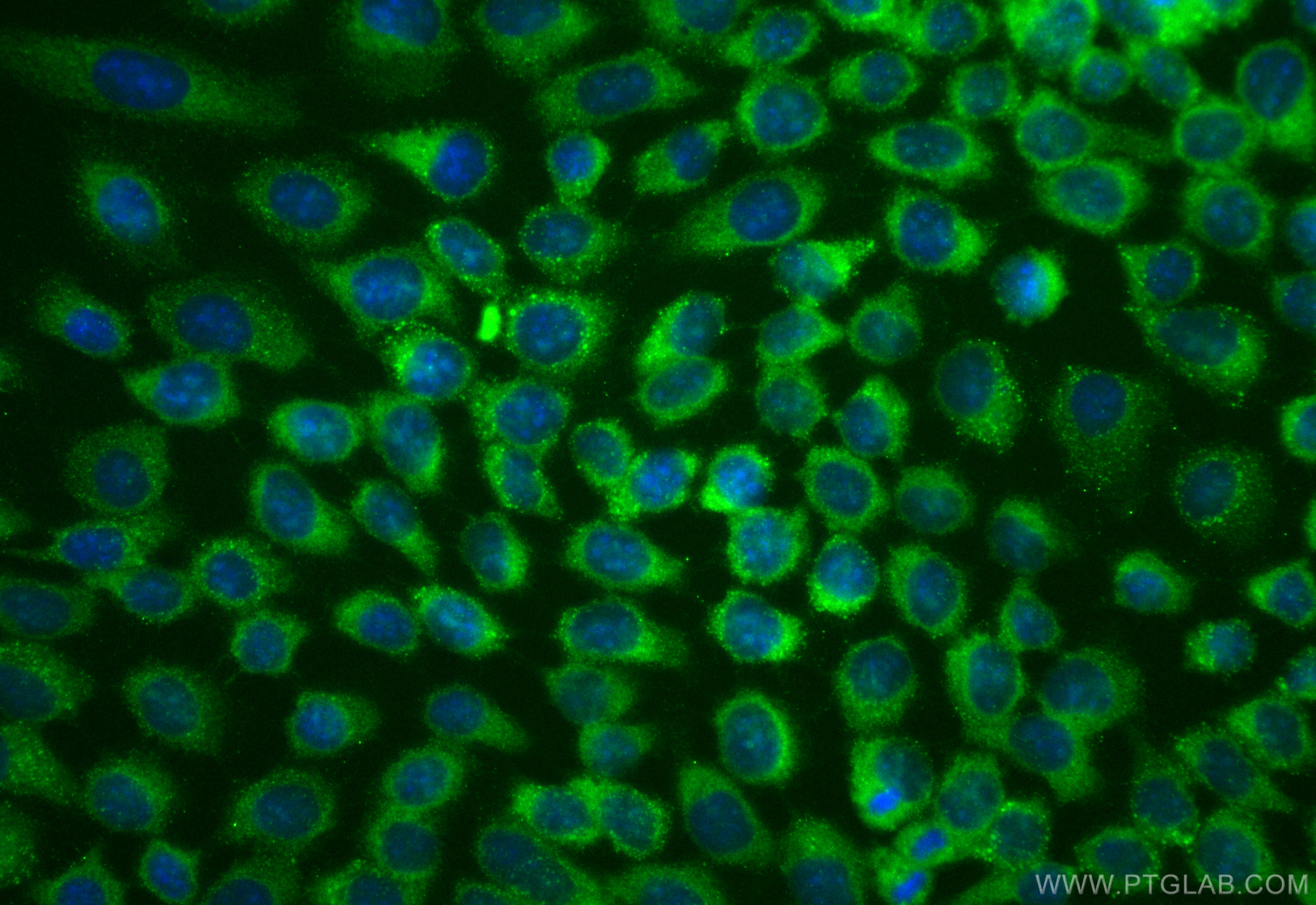 Immunofluorescent analysis of (-20°C Methanol) fixed A431 cells using CoraLite® Plus 488 ASCC3 antibody (CL488-85130-2, Clone: 242755B4 ) at dilution of 1:200. IF Staining of A431 using CL488-85130-2