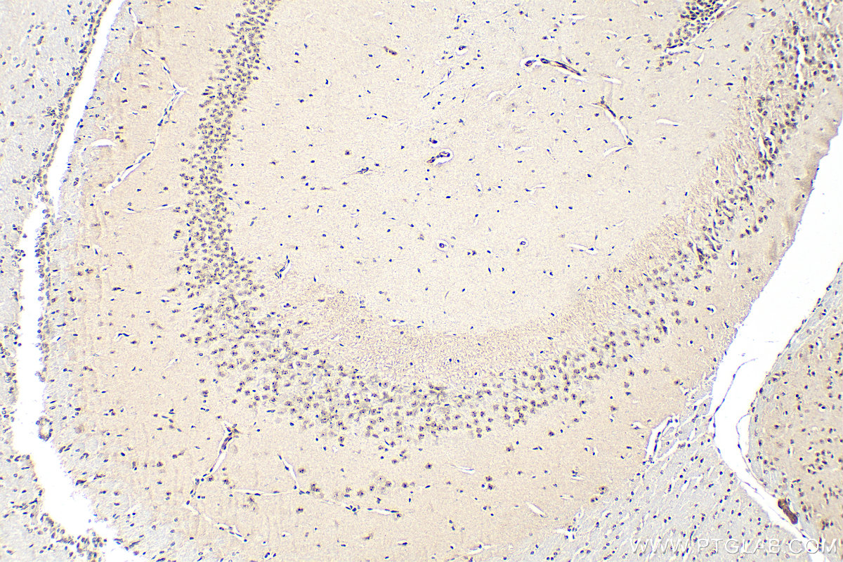 IHC staining of mouse brain using 31206-1-AP
