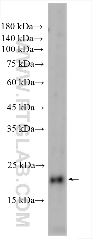 WB analysis of MKN-45 using 21368-1-AP