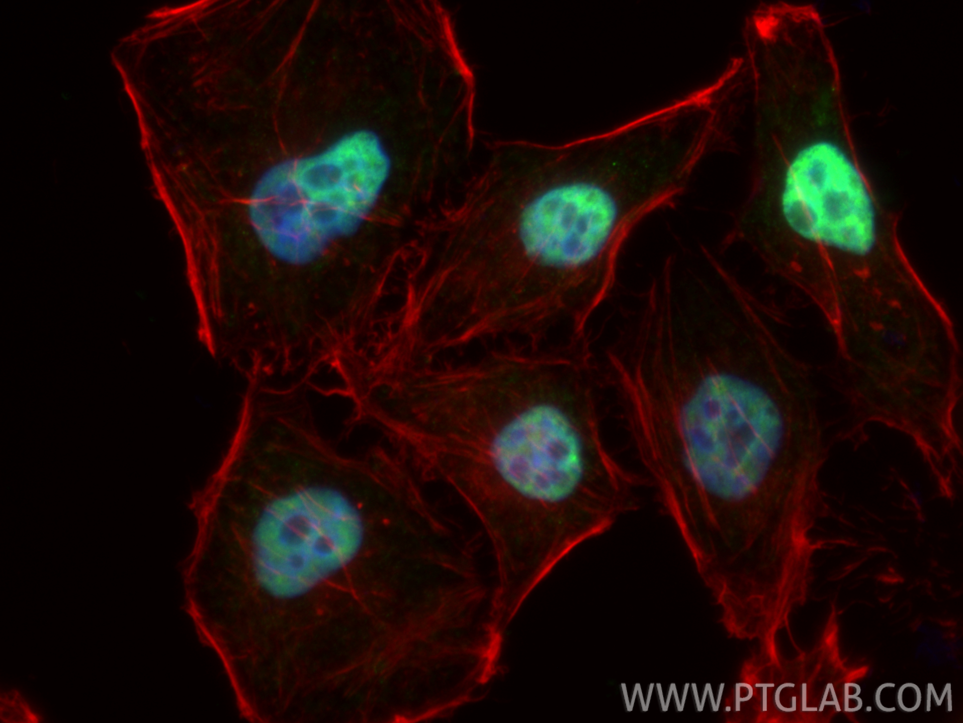 IF Staining of HepG2 using 66671-1-Ig