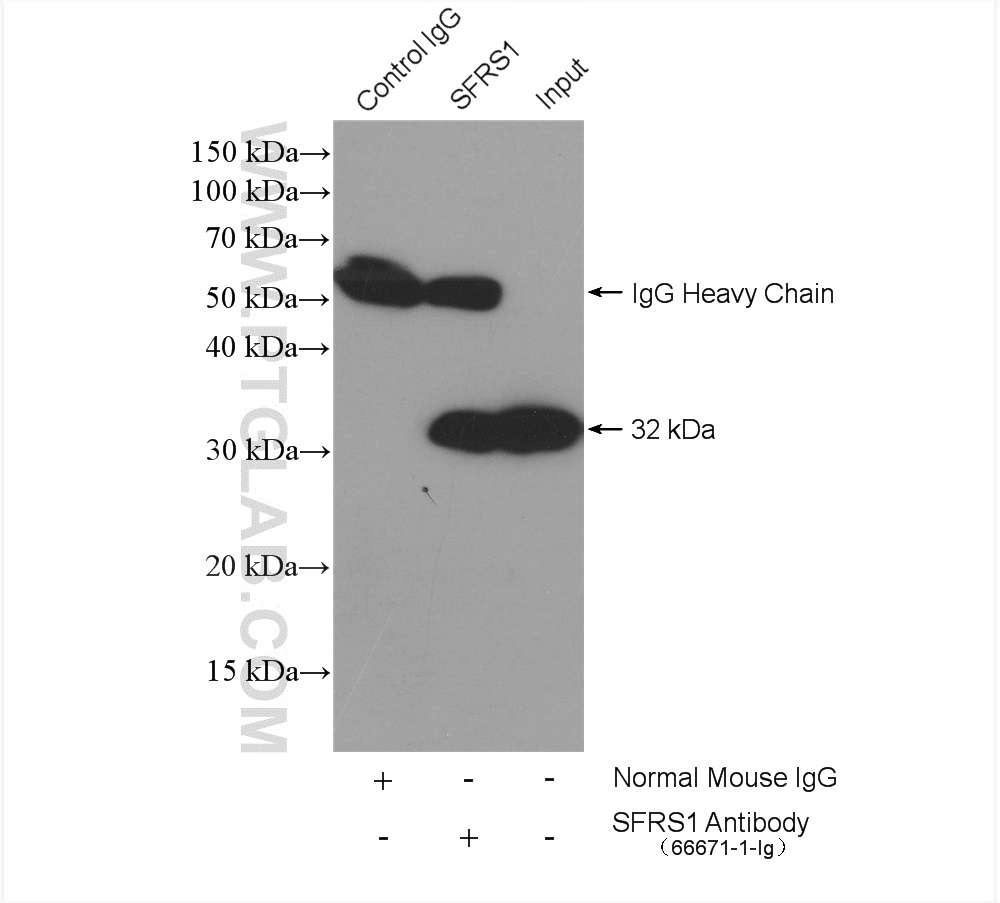 IP experiment of HeLa using 66671-1-Ig