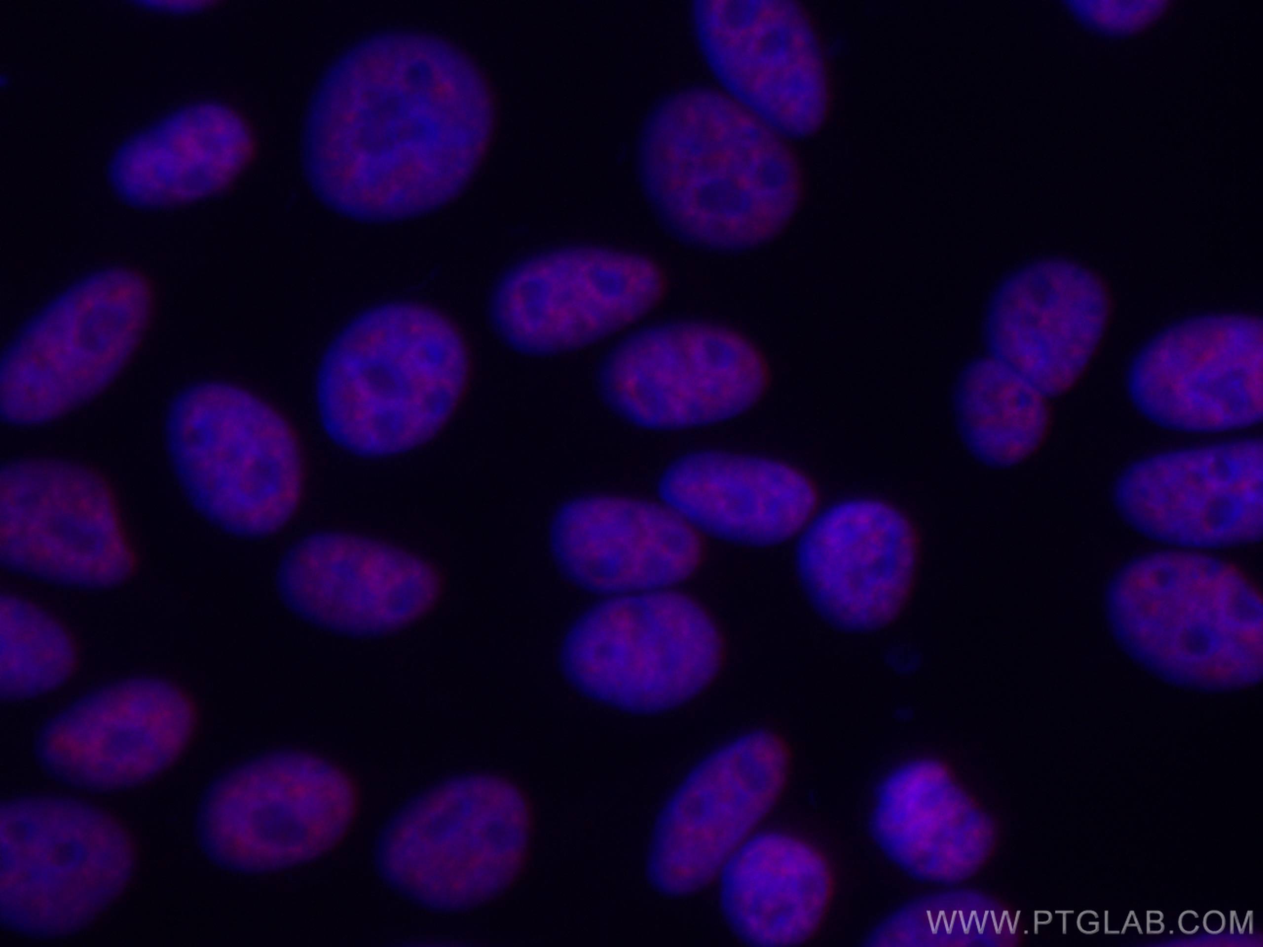 IF Staining of HepG2 using CL594-66671