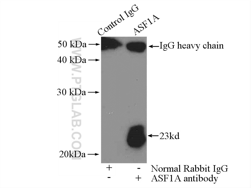 IP experiment of HEK-293 using 10784-1-AP