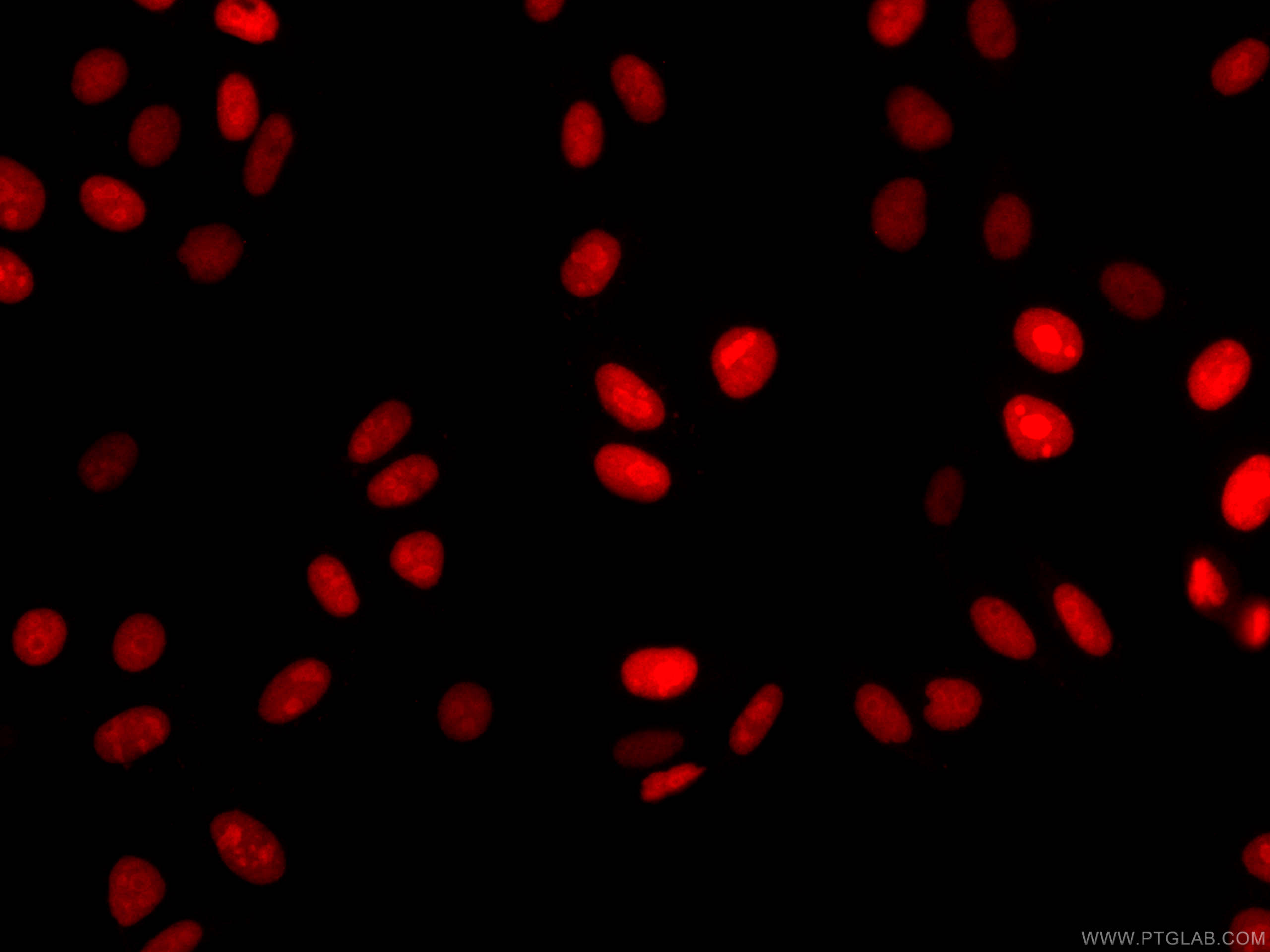 IF Staining of HepG2 using CL594-66884