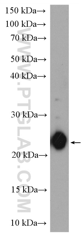 WB analysis of mouse thymus using 11011-1-AP (same clone as 11011-1-PBS)