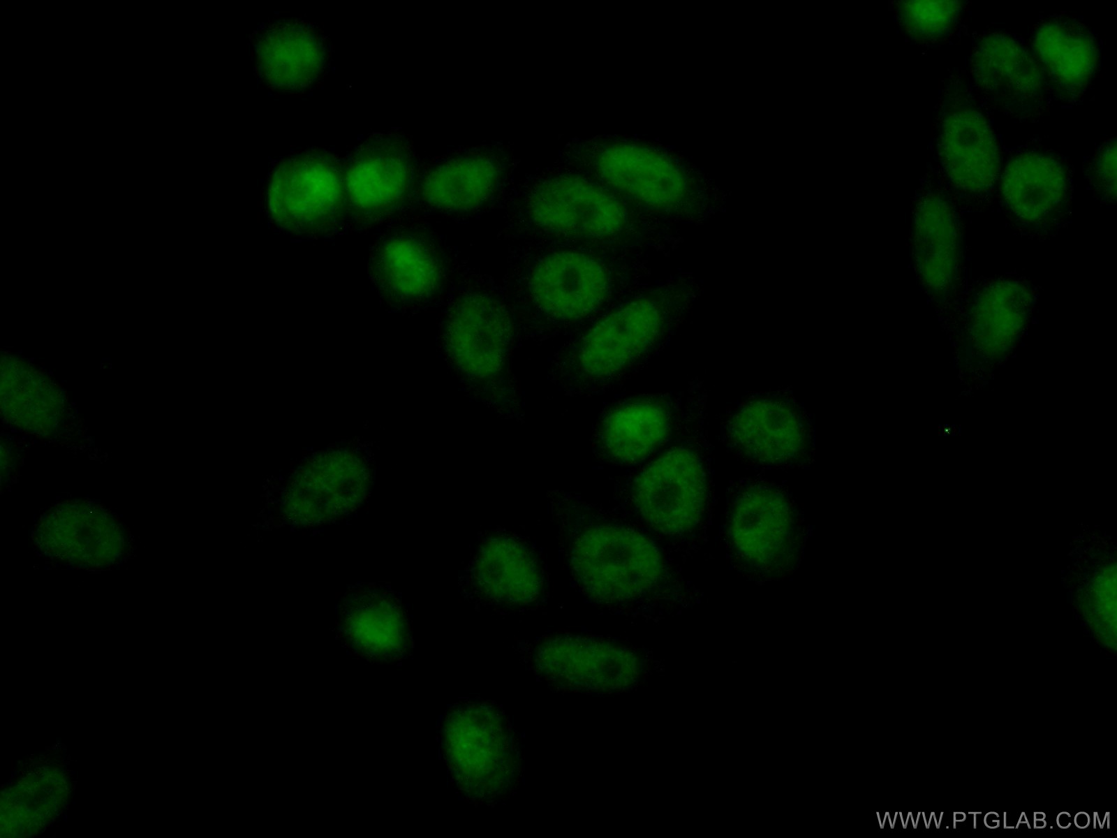 IF Staining of HeLa using 22258-1-AP (same clone as 22258-1-PBS)