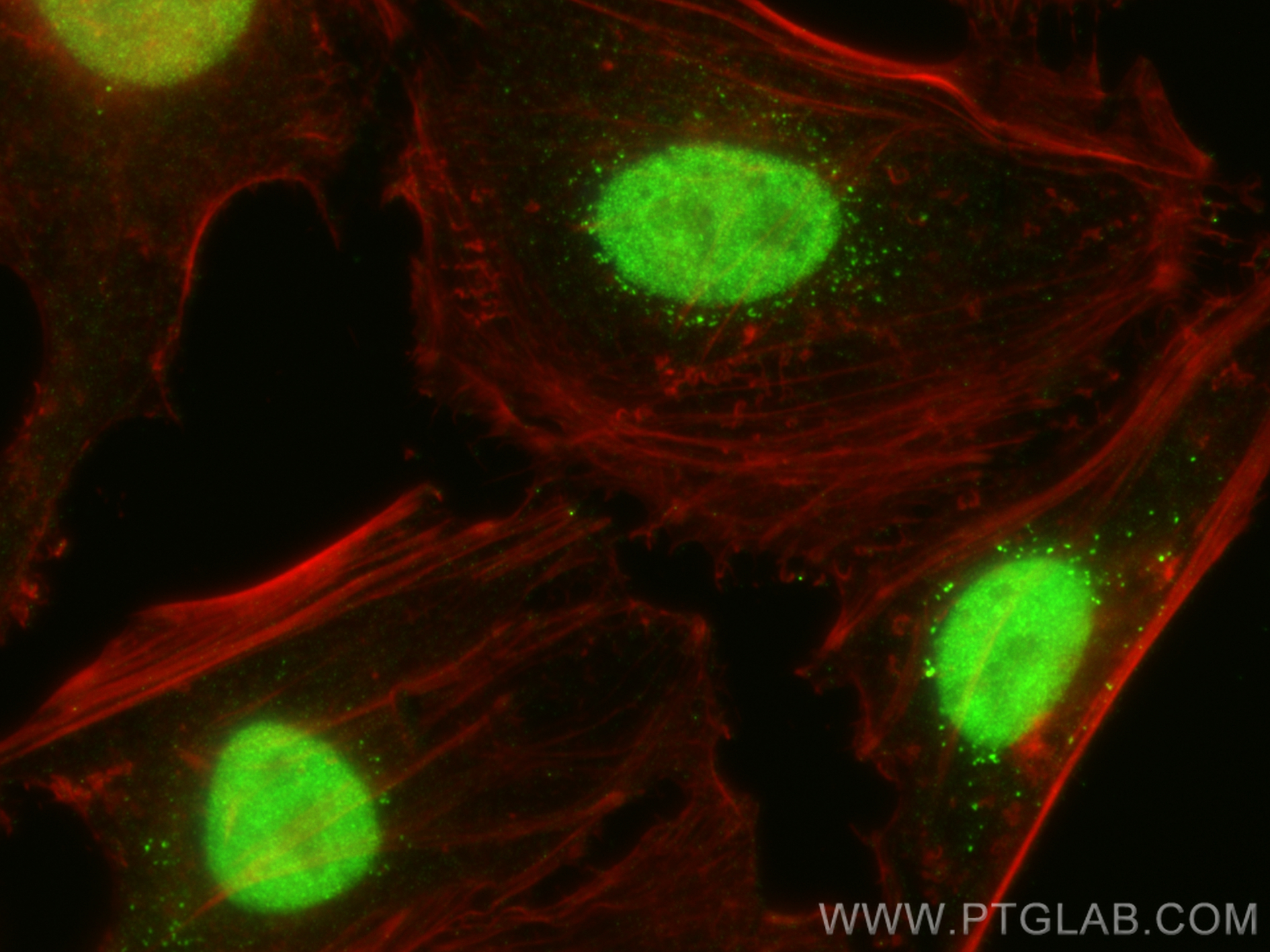IF Staining of HeLa using 22258-1-AP (same clone as 22258-1-PBS)