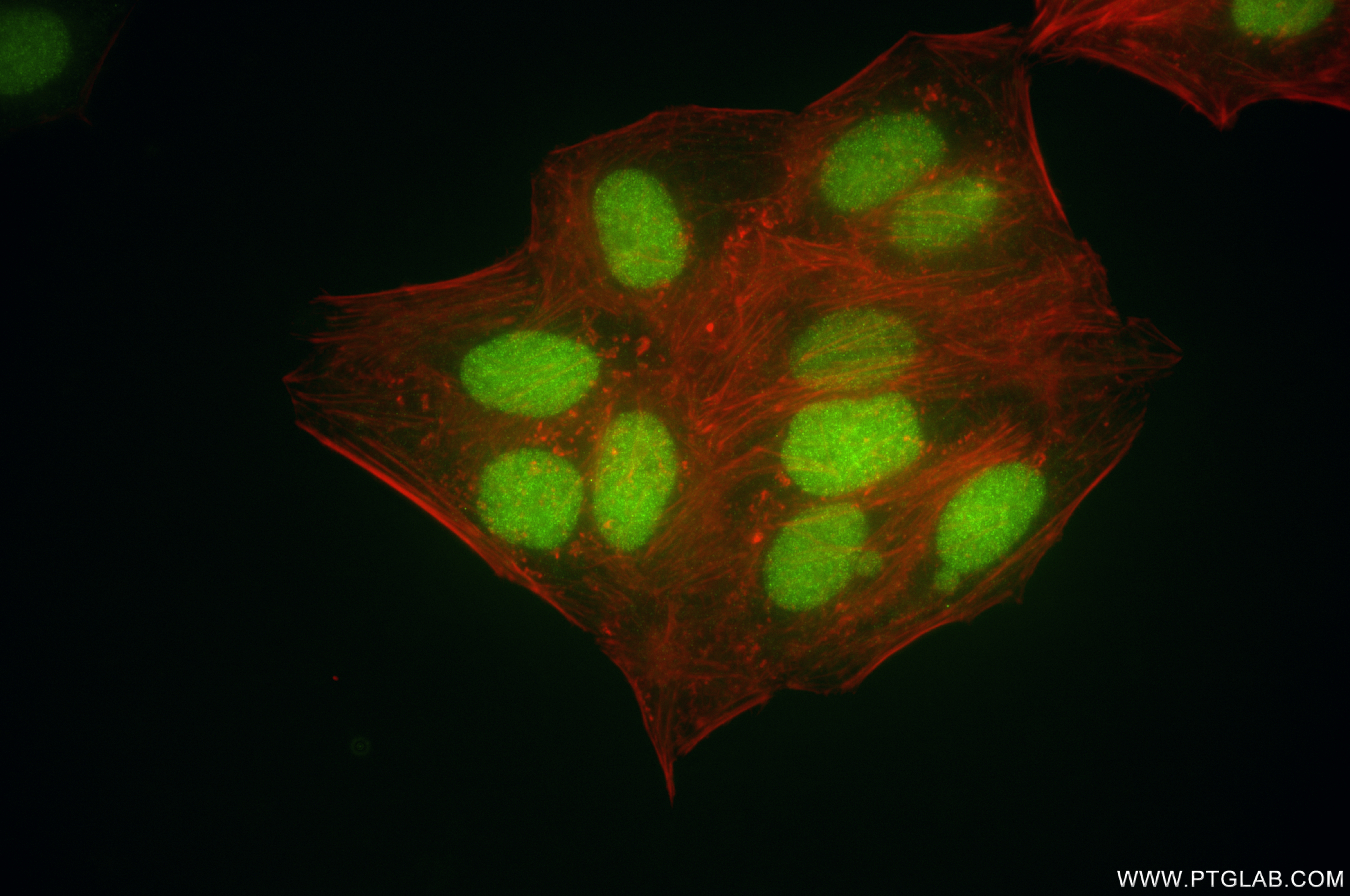 IF Staining of HepG2 using 85848-1-RR