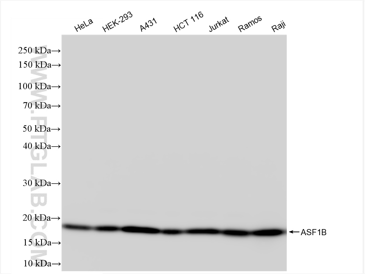 WB analysis using 85848-4-RR (same clone as 85848-4-PBS)