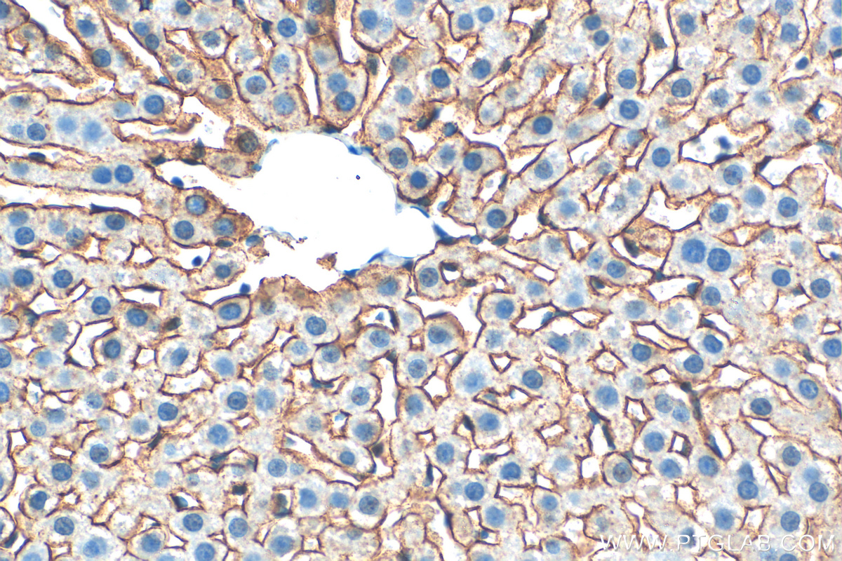 IHC staining of rat liver using 11739-1-AP