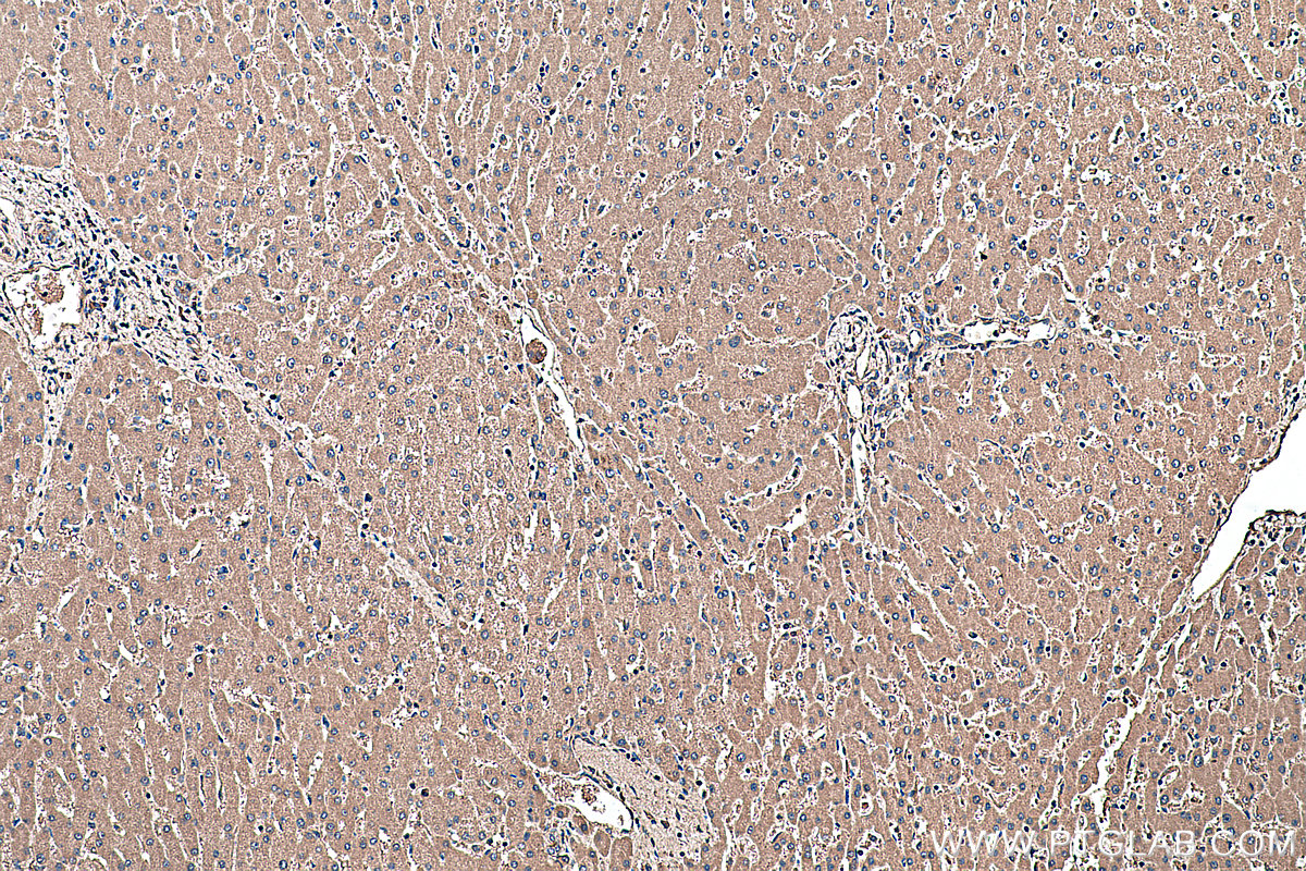 IHC staining of human liver using 66692-1-Ig