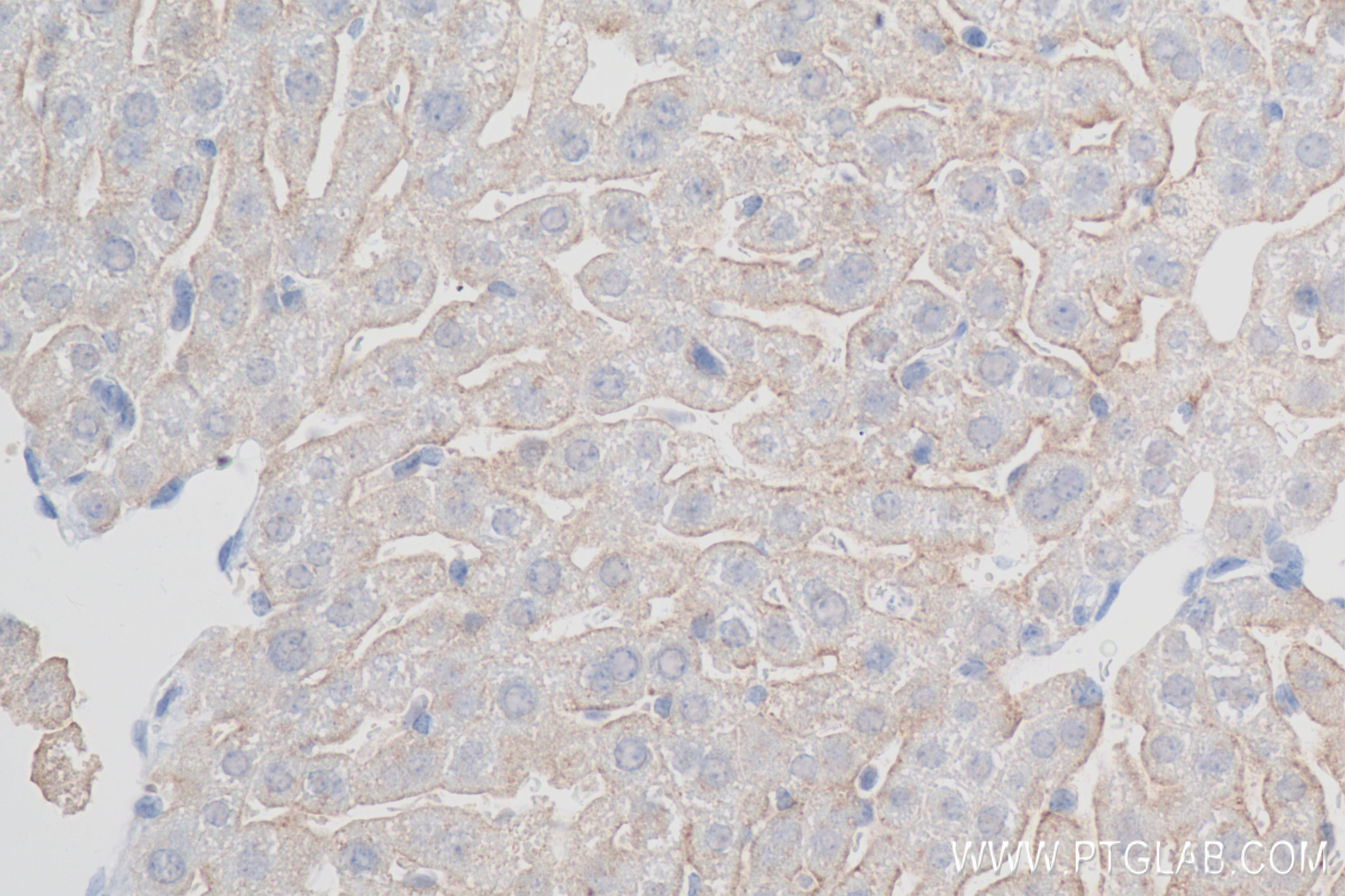 IHC staining of mouse liver using 83691-3-RR (same clone as 83691-3-PBS)